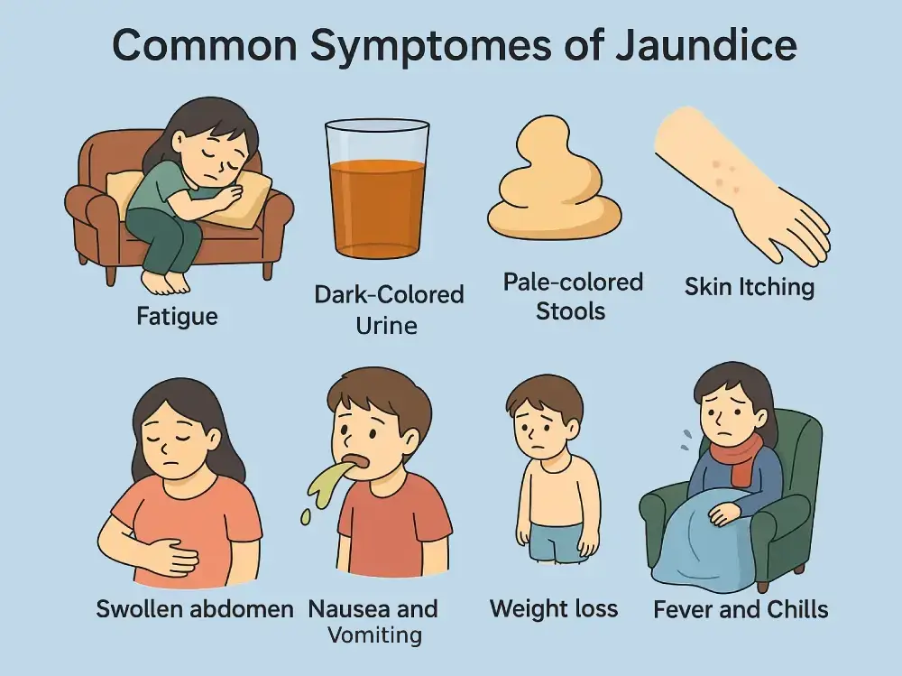 Symptoms and Signs of jaundice
