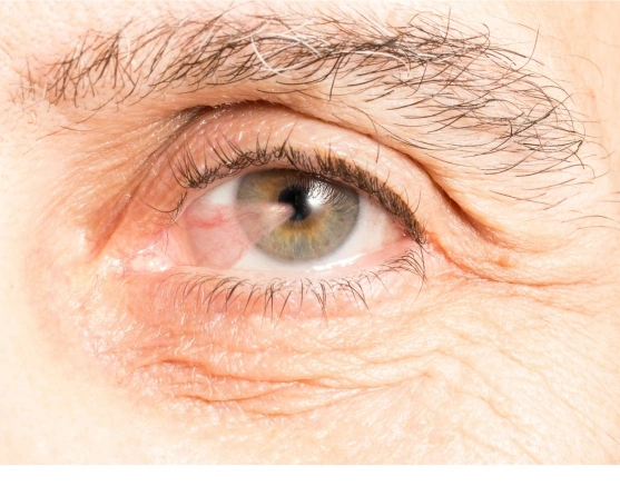 Doctor diagnosing the eye
