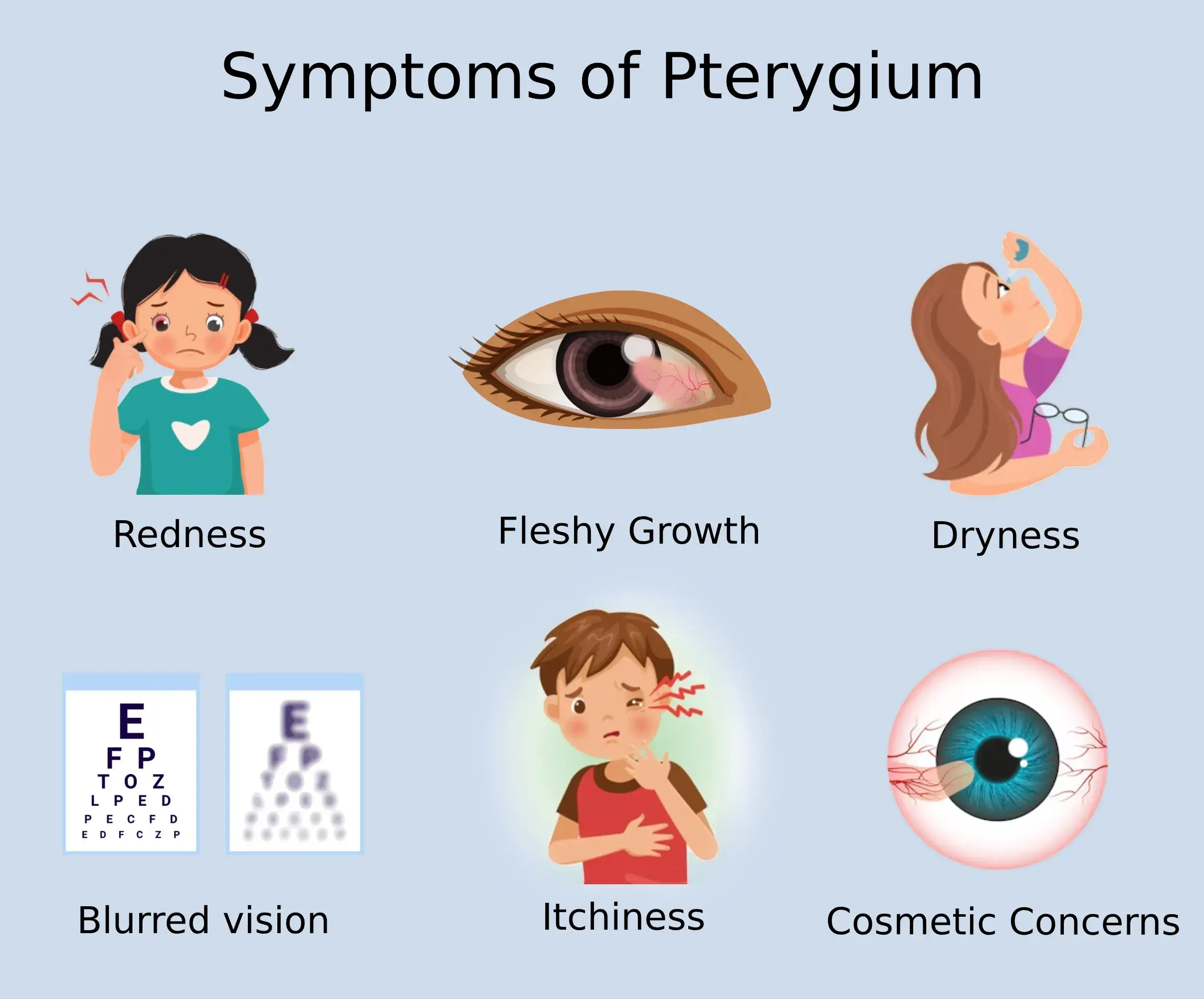 Common Symptoms of Pterygium